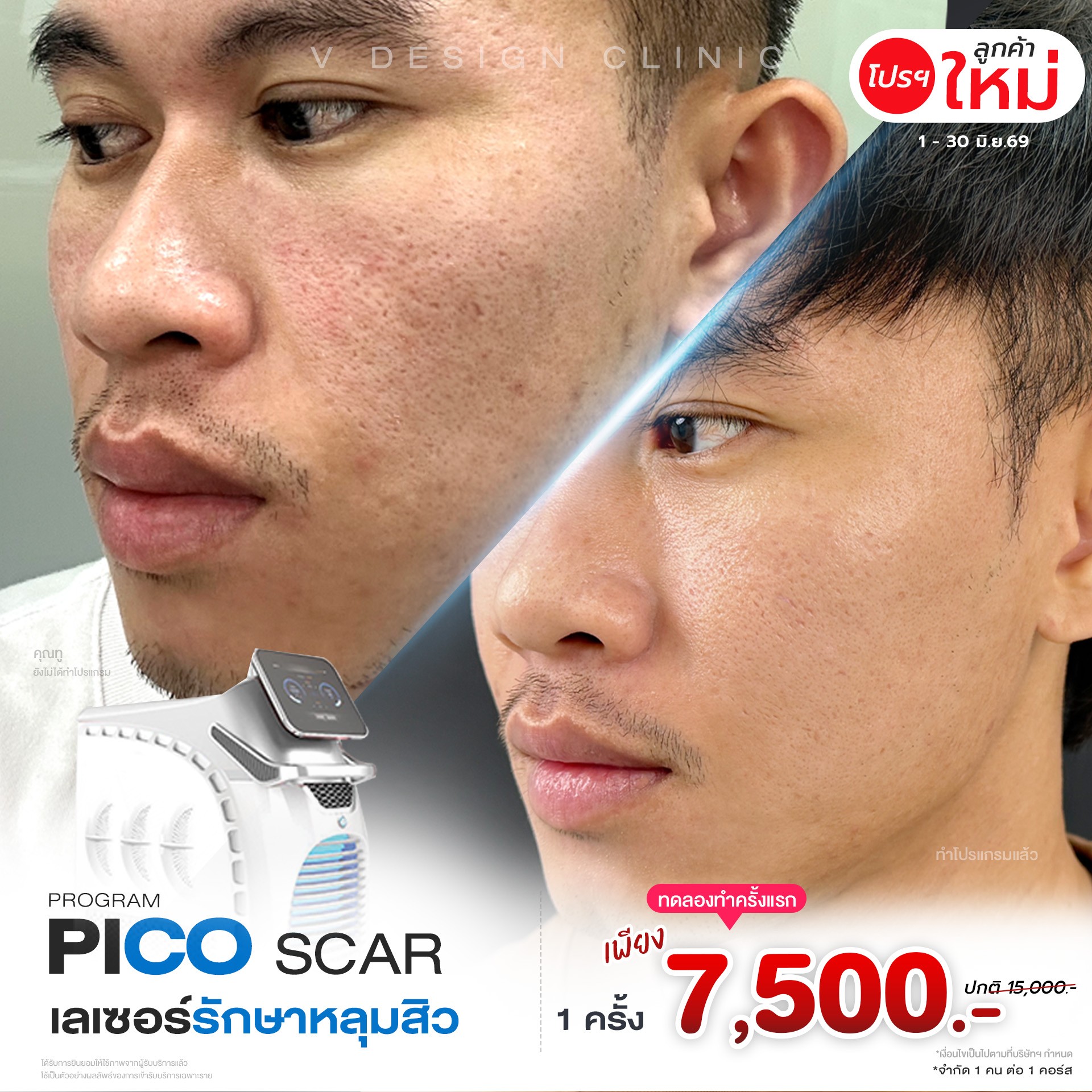 promotion img
